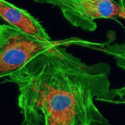 怎么提高顯微鏡的熒光成像的質(zhì)量？